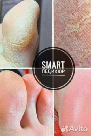 Маникюр, покрытие гель-лак, Smart педикюр